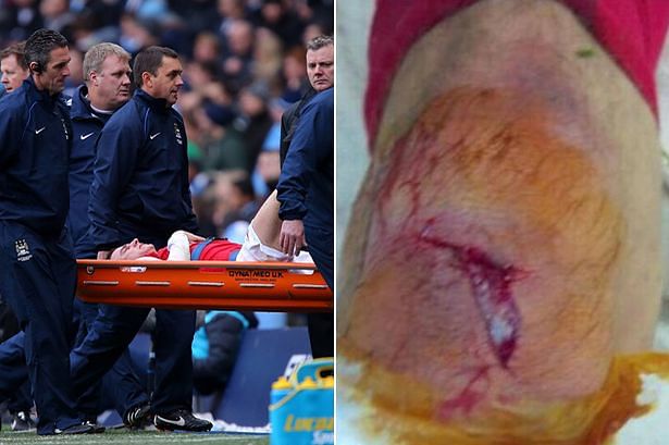 Laurent Koscielny's injury presents Thomas Vermaelen his chance