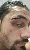 Roman Reigns suffers injury at WWE Live Event