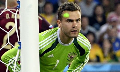 Russia goalkeeper Igor Akinfeev blinded by laser: Fabio Capello