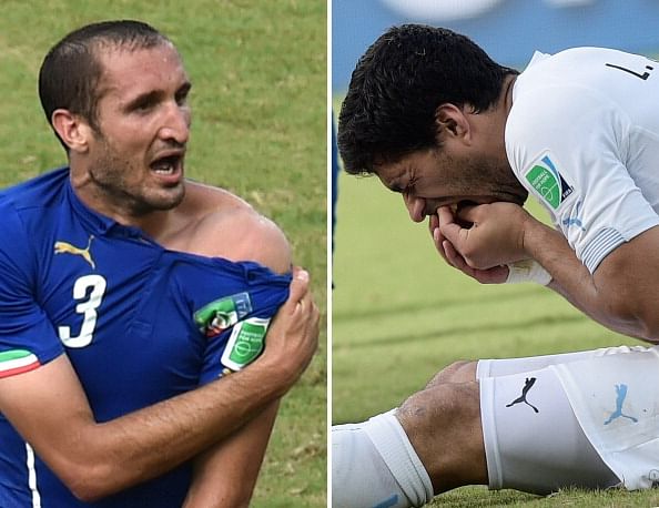 Is biting really the biggest crime in football?
