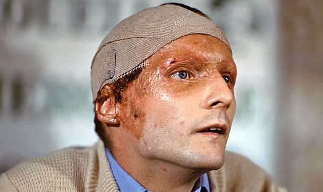 Niki Lauda at a press conference in 1976 after his accident.