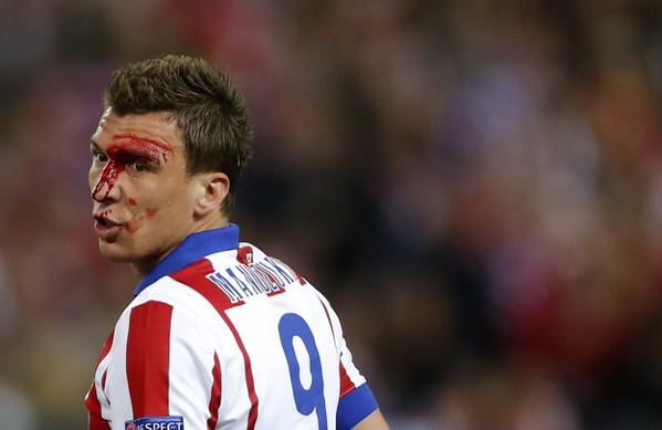 Mario Mandzukic