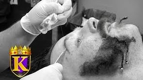 Sheamus gets stitches, Bad News Barrett talks King of the Ring victory, more