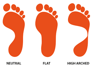 Types of Foot Arches