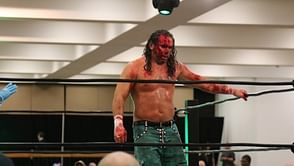 How serious is Matt Hardy's wound?, Hardy posts new photos on Twitter