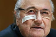 Blatter