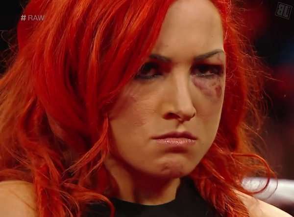 5 Times WWE Superstars were assaulted by non-wrestlers
