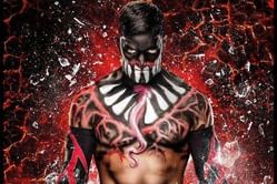 WWE News: Finn Balor receives stem cell injections to help nurse injury