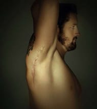 Wade Barrett's injuries