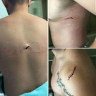 Jamie Noble's injuries