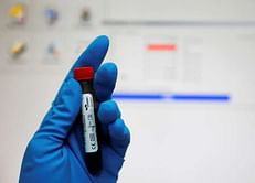 Doping scheme may have touched all Russian athletes: WADA