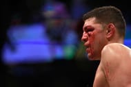 LAS VEGAS, NV - JANUARY 31: Nick Diaz stands in the Octagon after taking a hit from Anderson Silva in a middleweight bout against Anderson Silva during UFC 183 at the MGM Grand Garden Arena on January 31, 2015 in Las Vegas, Nevada. Silva won by unanimous decision. (Photo by Steve Marcus/Getty Images)