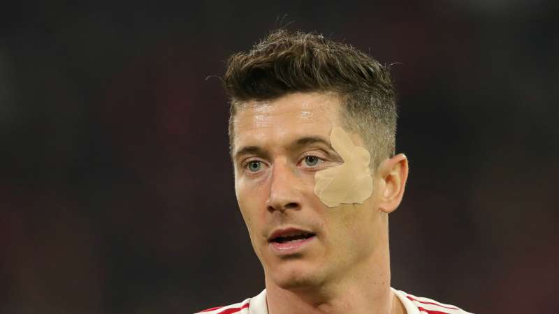 Robert Lewandowski Hair Sometimes you need to change something